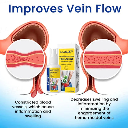 LAOZIK Herbal Hemorrhoids Fast-Acting Treatment Spray